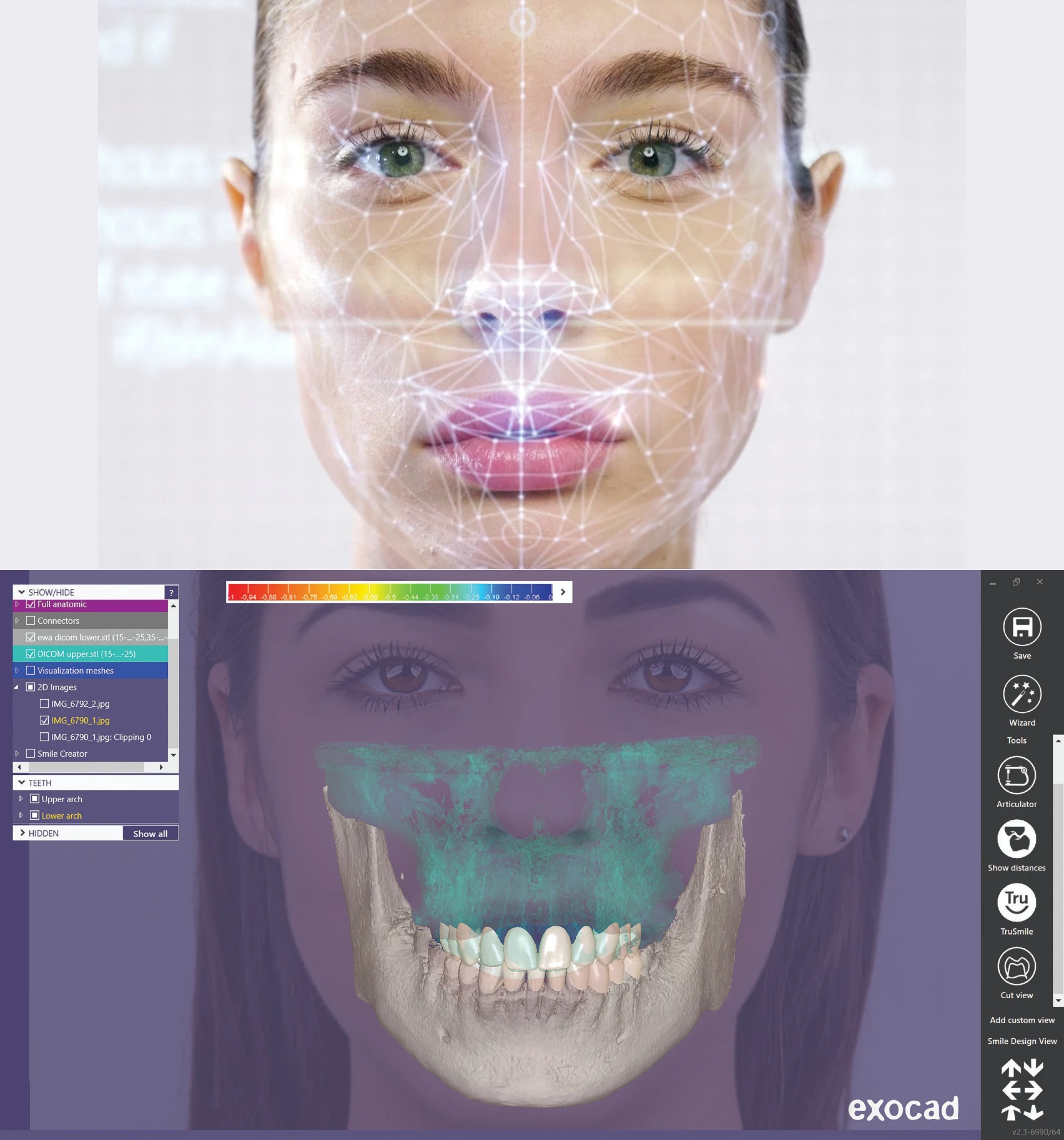 Facial scanner at Origin Dental Implant Studio