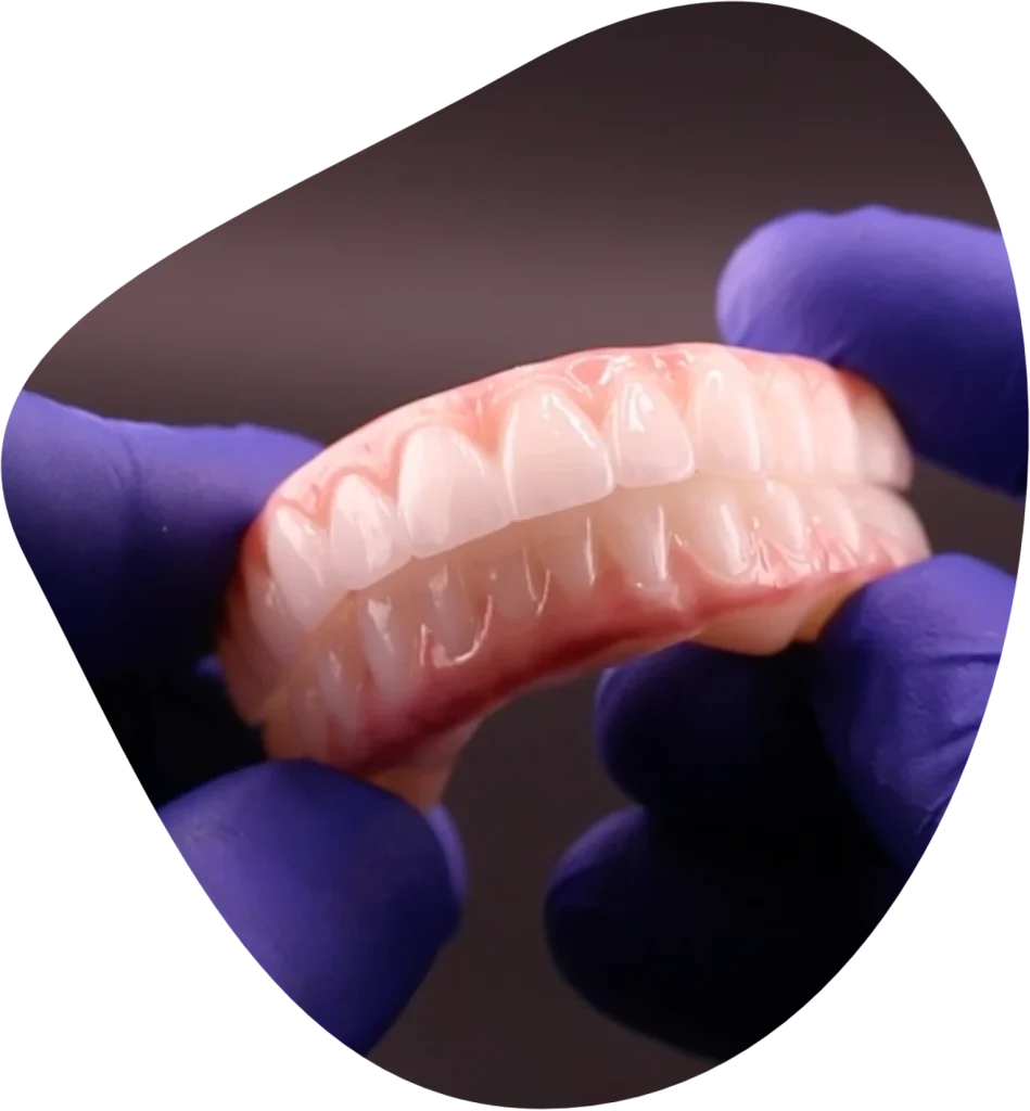 Explore the cost of dental implants in Atlanta. 100% Transparent Pricing – 0% Financing Available. FREE Consultations!