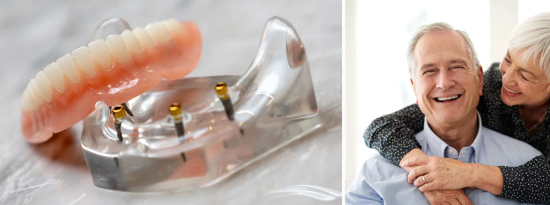 Senior man smiling with snap in dentures